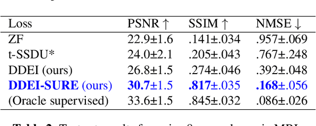 Figure 4 for Fully Unsupervised Dynamic MRI Reconstruction via Diffeo-Temporal Equivariance