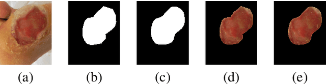 Figure 2 for An Enhanced Harmonic Densely Connected Hybrid Transformer Network Architecture for Chronic Wound Segmentation Utilising Multi-Colour Space Tensor Merging