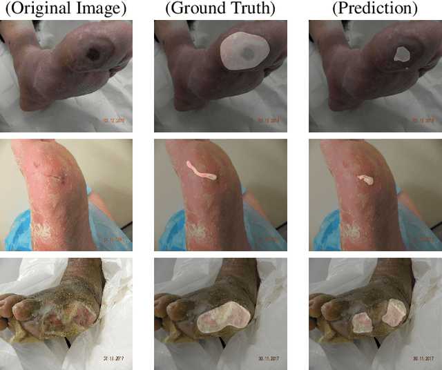 Figure 4 for An Enhanced Harmonic Densely Connected Hybrid Transformer Network Architecture for Chronic Wound Segmentation Utilising Multi-Colour Space Tensor Merging