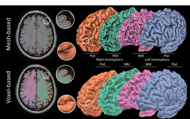 Figure 1 for Neural deformation fields for template-based reconstruction of cortical surfaces from MRI