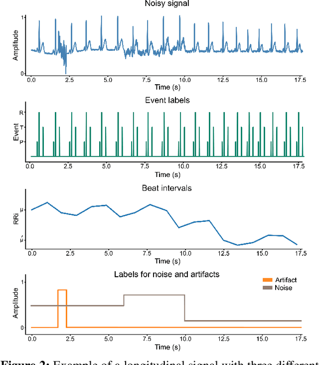 Figure 2 for Flexible framework for generating synthetic electrocardiograms and photoplethysmograms