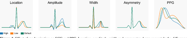 Figure 4 for Flexible framework for generating synthetic electrocardiograms and photoplethysmograms