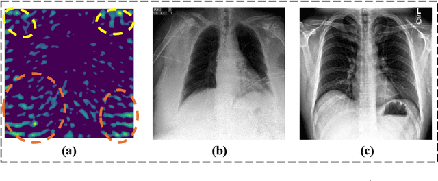 Figure 4 for Universal Debiased Editing on Foundation Models for Fair Medical Image Classification