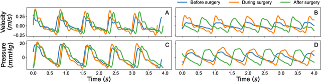 Figure 1 for Machine learning for cerebral blood vessels' malformations