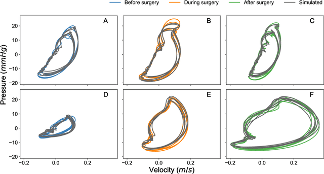 Figure 3 for Machine learning for cerebral blood vessels' malformations