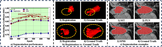 Figure 1 for Self-Paced Sample Selection for Barely-Supervised Medical Image Segmentation