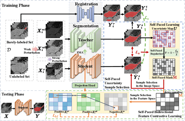 Figure 3 for Self-Paced Sample Selection for Barely-Supervised Medical Image Segmentation