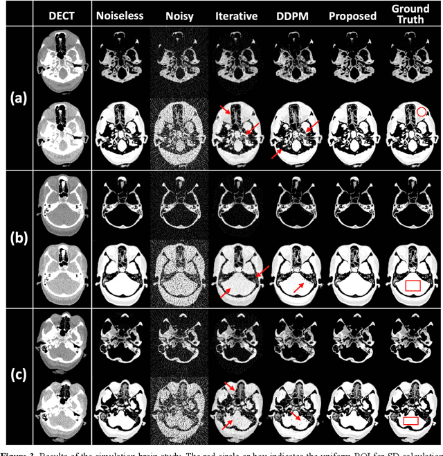 Figure 3 for Image-Domain Material Decomposition for Dual-energy CT using Unsupervised Learning with Data-fidelity Loss