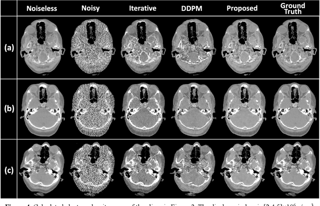 Figure 4 for Image-Domain Material Decomposition for Dual-energy CT using Unsupervised Learning with Data-fidelity Loss