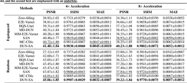 Figure 2 for Deep Unfolding Network with Spatial Alignment for multi-modal MRI reconstruction