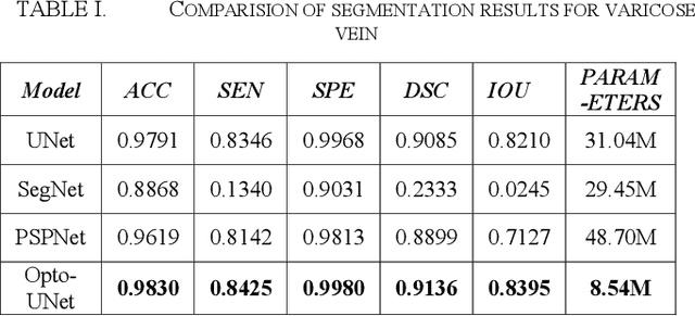 Figure 4 for Opto-UNet: Optimized UNet for Segmentation of Varicose Veins in Optical Coherence Tomography