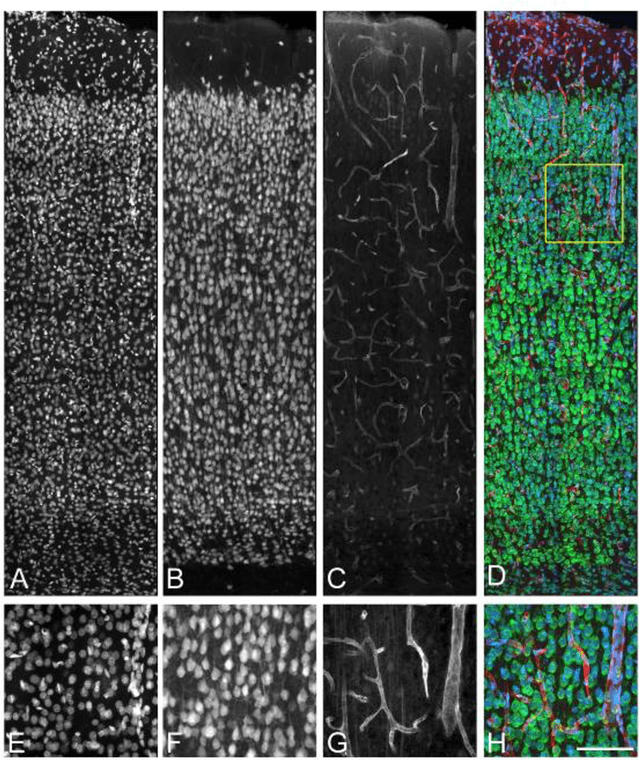 Figure 1 for 3D Segmentation of Neuronal Nuclei and Cell-Type Identification using Multi-channel Information