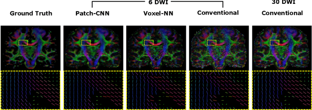 Figure 3 for Patch-CNN: Training data-efficient deep learning for high-fidelity diffusion tensor estimation from minimal diffusion protocols