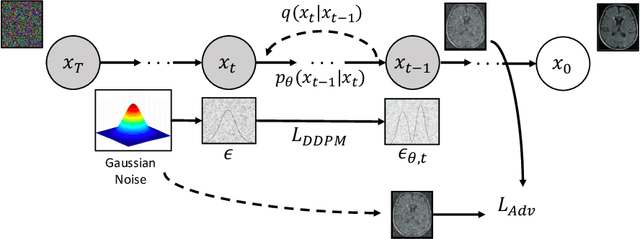 Figure 1 for Adversarial Denoising Diffusion Model for Unsupervised Anomaly Detection
