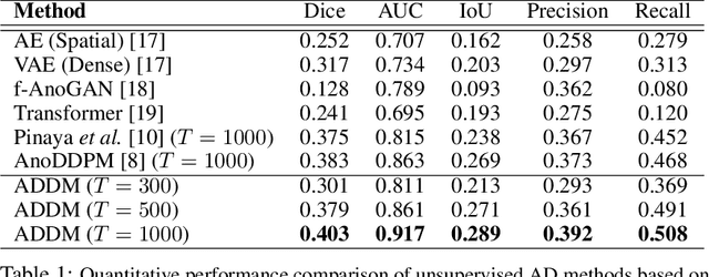 Figure 2 for Adversarial Denoising Diffusion Model for Unsupervised Anomaly Detection