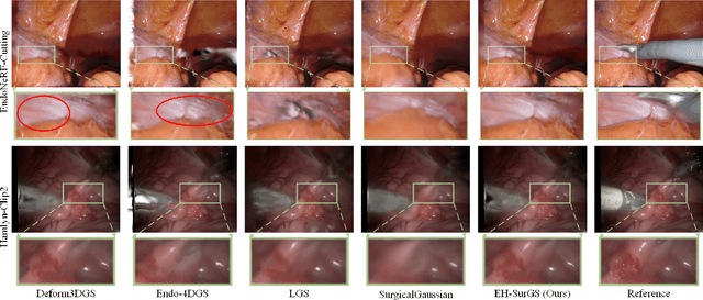 Figure 3 for Deformable Gaussian Splatting for Efficient and High-Fidelity Reconstruction of Surgical Scenes