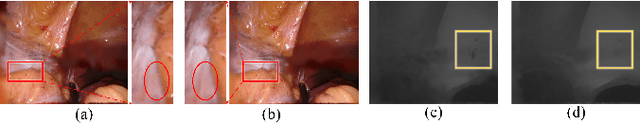 Figure 4 for Deformable Gaussian Splatting for Efficient and High-Fidelity Reconstruction of Surgical Scenes