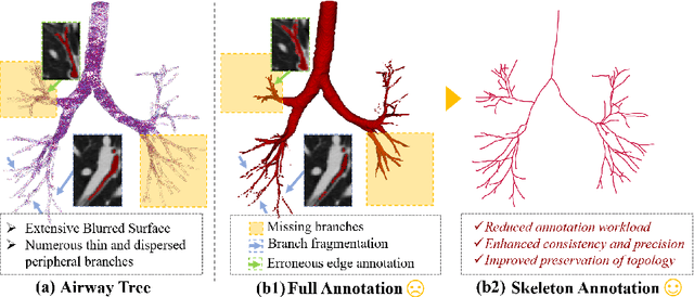 Figure 1 for Skeleton Supervised Airway Segmentation