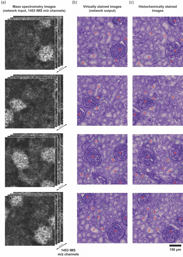 Figure 2 for Virtual Staining of Label-Free Tissue in Imaging Mass Spectrometry