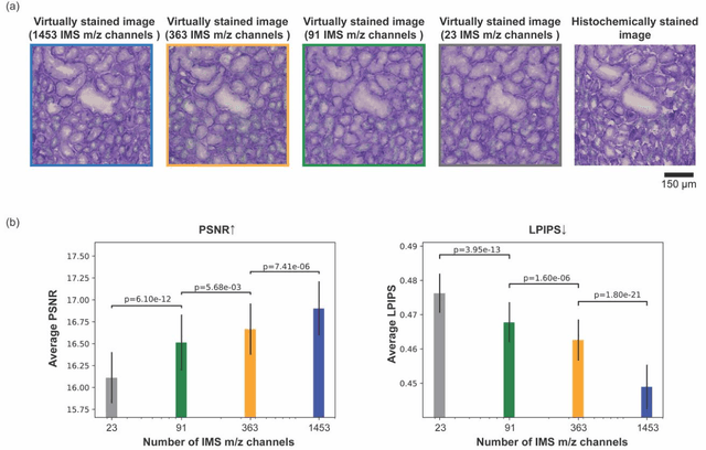 Figure 4 for Virtual Staining of Label-Free Tissue in Imaging Mass Spectrometry