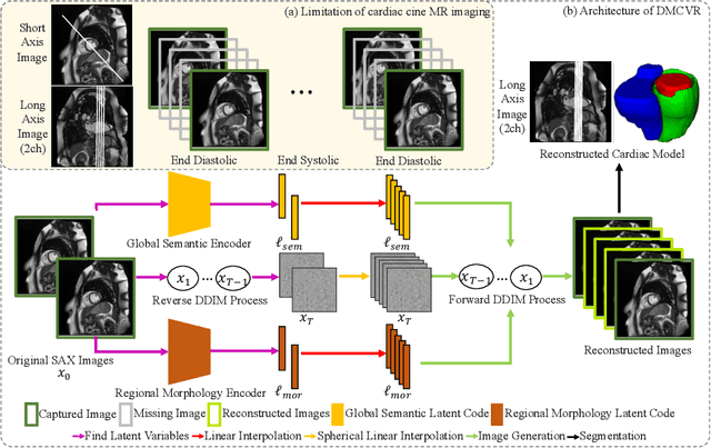 Figure 1 for DMCVR: Morphology-Guided Diffusion Model for 3D Cardiac Volume Reconstruction
