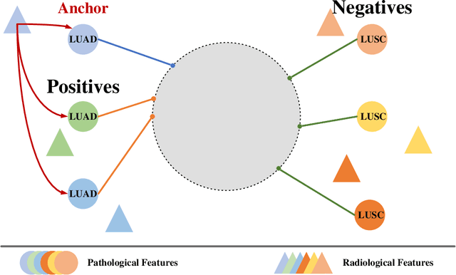 Figure 3 for CC-DCNet: Dynamic Convolutional Neural Network with Contrastive Constraints for Identifying Lung Cancer Subtypes on Multi-modality Images