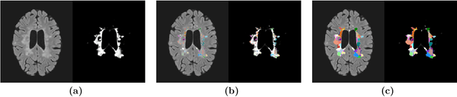 Figure 1 for Unique MS Lesion Identification from MRI