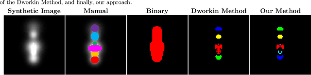 Figure 3 for Unique MS Lesion Identification from MRI