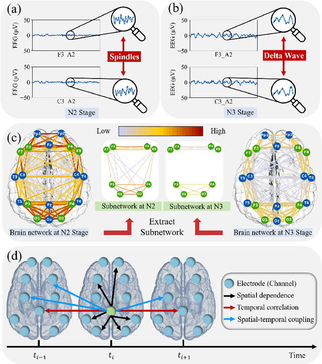 Figure 1 for ST-USleepNet: A Spatial-Temporal Coupling Prominence Network for Multi-Channel Sleep Staging