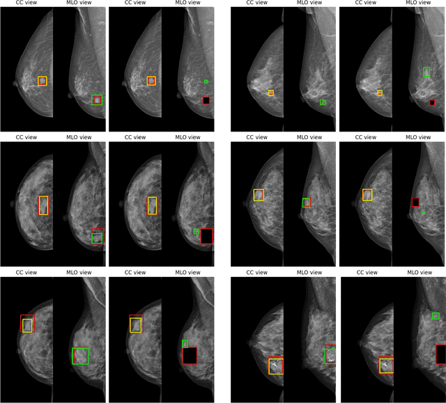 Figure 2 for TransReg: Cross-transformer as auto-registration module for multi-view mammogram mass detection