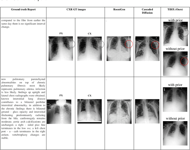 Figure 4 for TiBiX: Leveraging Temporal Information for Bidirectional X-ray and Report Generation