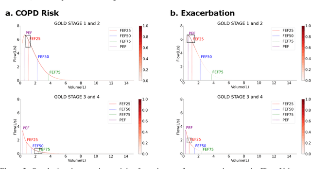 Figure 3 for Transformer-based Time-Series Biomarker Discovery for COPD Diagnosis