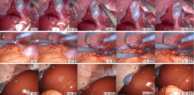 Figure 4 for Online 3D reconstruction and dense tracking in endoscopic videos