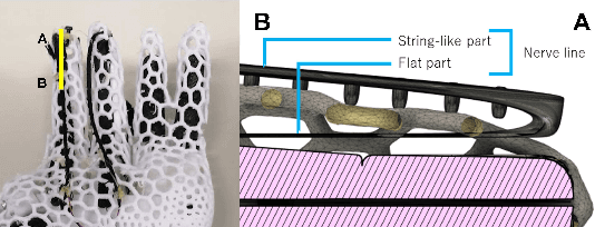 Figure 4 for Design of a Five-Fingered Hand with Full-Fingered Tactile Sensors Using Conductive Filaments and Its Application to Bending after Insertion Motion