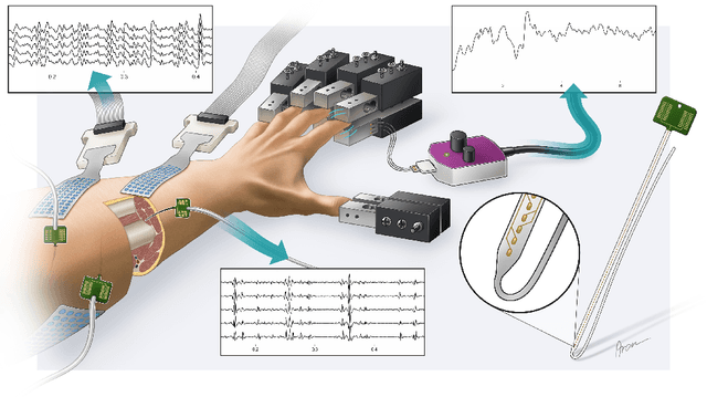 Figure 1 for Intramuscular High-Density Micro-Electrode Arrays Enable High-Precision Decoding and Mapping of Spinal Motor Neurons to Reveal Hand Control