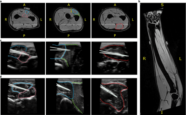 Figure 2 for Intramuscular High-Density Micro-Electrode Arrays Enable High-Precision Decoding and Mapping of Spinal Motor Neurons to Reveal Hand Control