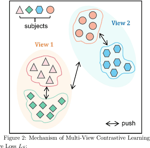 Figure 3 for A Learnable Multi-views Contrastive Framework with Reconstruction Discrepancy for Medical Time-Series