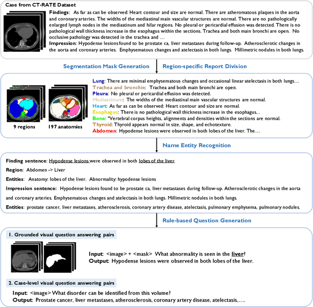 Figure 3 for RadGenome-Chest CT: A Grounded Vision-Language Dataset for Chest CT Analysis