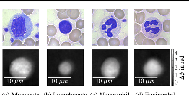 Figure 1 for Towards Interpretable Classification of Leukocytes based on Deep Learning