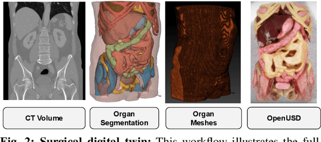 Figure 2 for SuFIA-BC: Generating High Quality Demonstration Data for Visuomotor Policy Learning in Surgical Subtasks