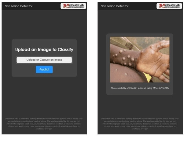 Figure 2 for A Web-based Mpox Skin Lesion Detection System Using State-of-the-art Deep Learning Models Considering Racial Diversity