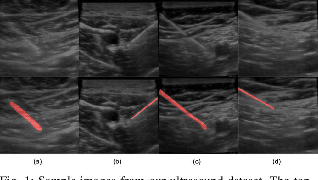 Figure 1 for Motion Informed Needle Segmentation in Ultrasound Images