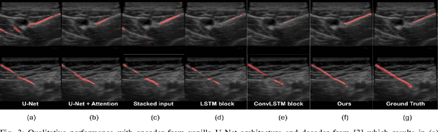 Figure 3 for Motion Informed Needle Segmentation in Ultrasound Images