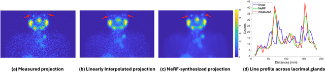 Figure 3 for Shorter SPECT Scans Using Self-supervised Coordinate Learning to Synthesize Skipped Projection Views