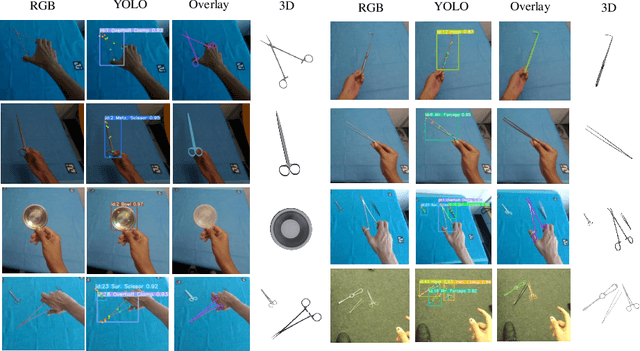 Figure 4 for SurgeoNet: Realtime 3D Pose Estimation of Articulated Surgical Instruments from Stereo Images using a Synthetically-trained Network