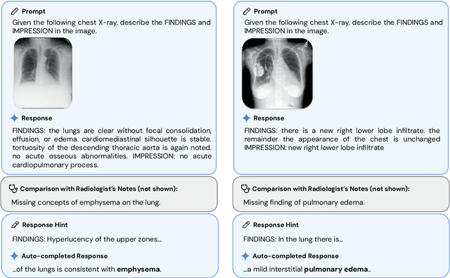 Figure 4 for Advancing Multimodal Medical Capabilities of Gemini