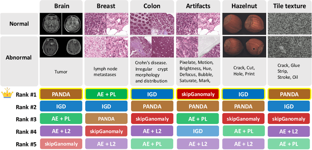 Figure 1 for Feasibility of Universal Anomaly Detection without Knowing the Abnormality in Medical Images