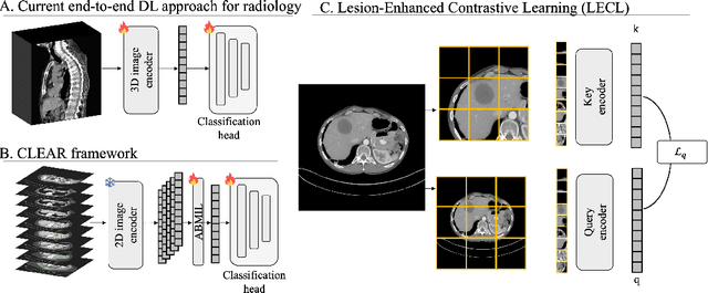 Figure 1 for Abnormality-Driven Representation Learning for Radiology Imaging