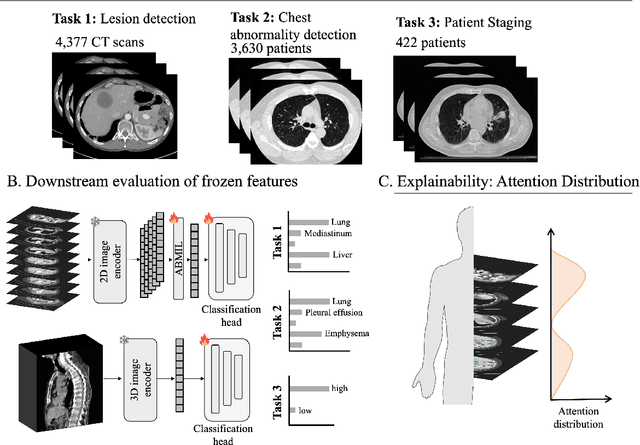 Figure 3 for Abnormality-Driven Representation Learning for Radiology Imaging