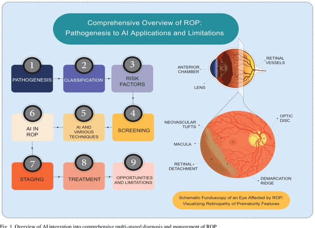 Figure 1 for Current and future roles of artificial intelligence in retinopathy of prematurity